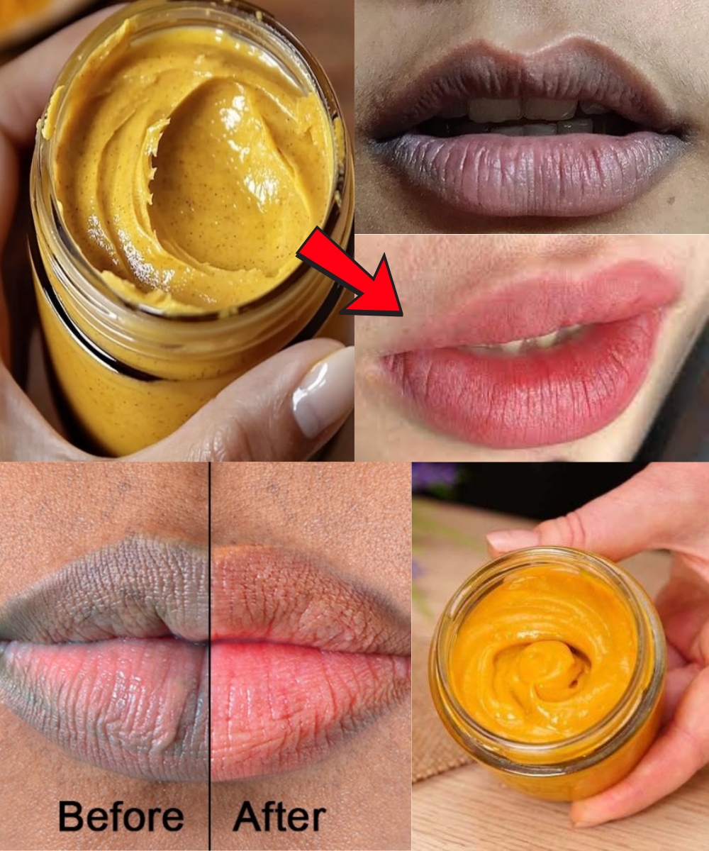 10 Effective Home Remedies to Lighten Dark Lips Naturally
