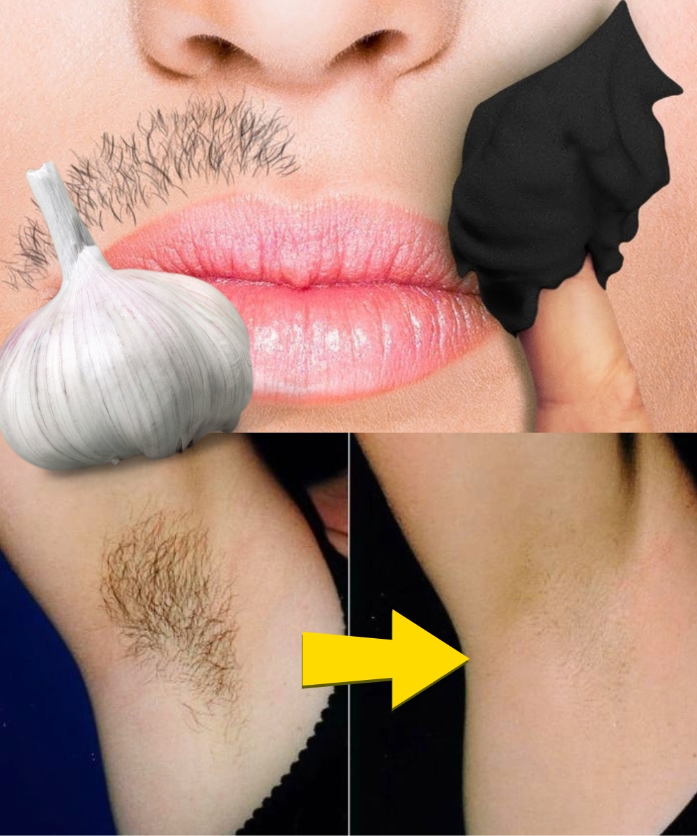 Stop Shaving Forever: Natural Ways to Permanently Remove Facial, Body & Intimate Hair
