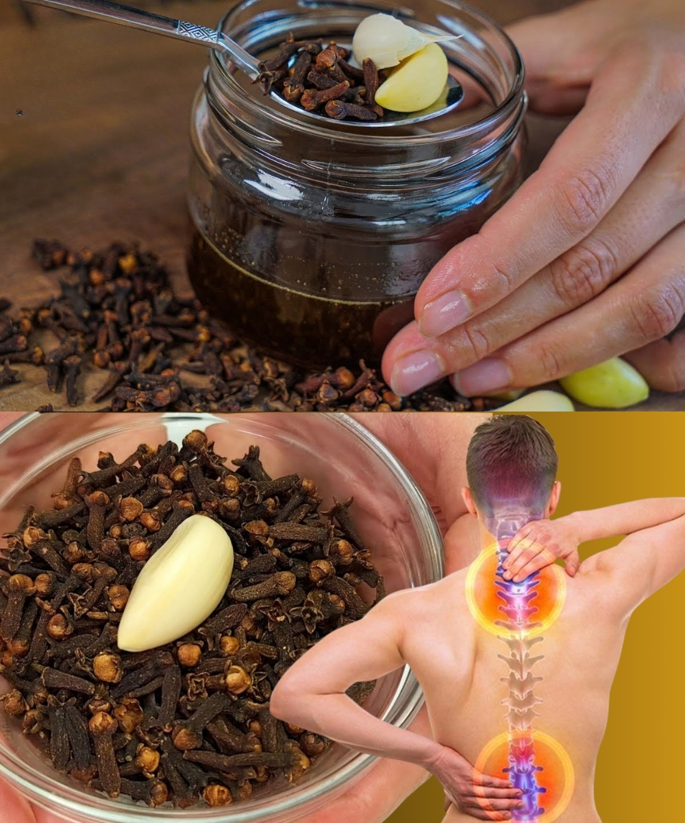 Say Goodbye to Joint Pain, Arthritis & Rheumatism in Just 3 Days — Try This Powerful Clove & Garlic Remedy!
