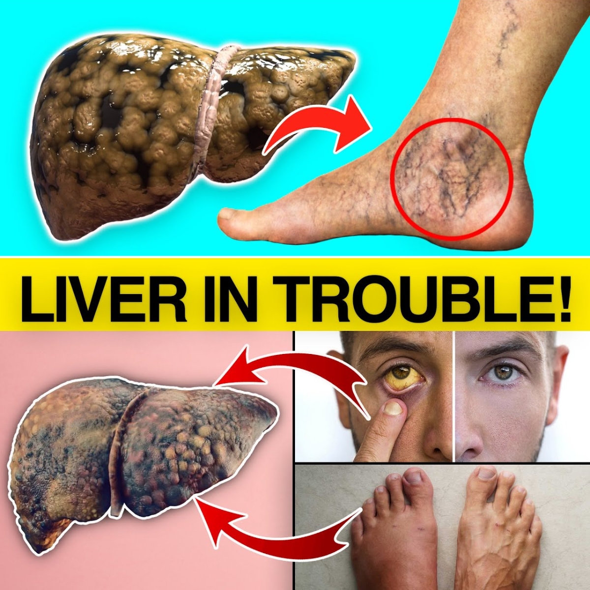 15 Early Warning Signs Your Liver Could Be in Trouble – Don’t Ignore These!