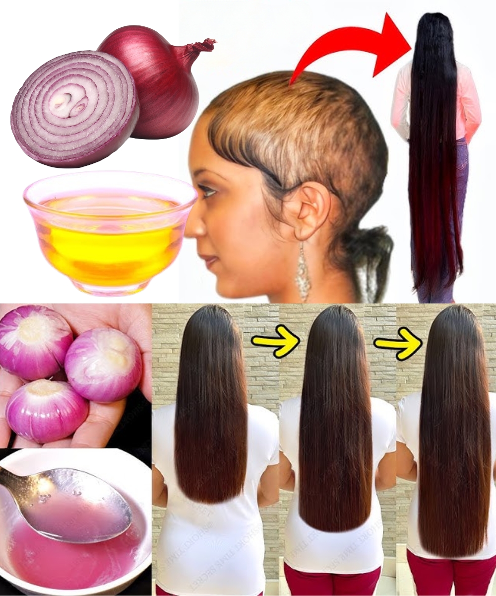 The Secret to Thicker, Faster-Growing Hair — Made with Just an Onion!