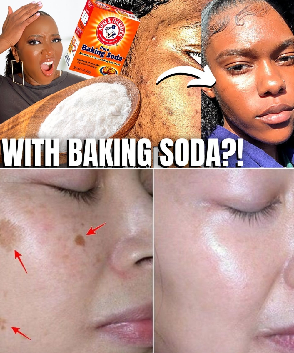 Banish Age Spots, Acne & Blackheads Instantly with Baking Soda!