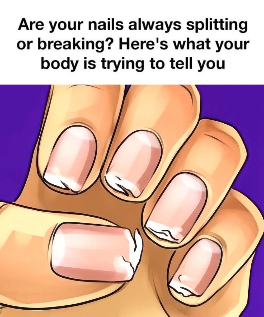 Your Nails Are Trying to Tell You Something—Here’s What They Reveal About Your Health!