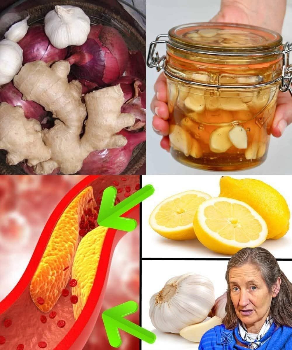Take 1 Teaspoon Daily of Garlic, Ginger, Onion, Lemon & Honey – The Results Will Shock You!