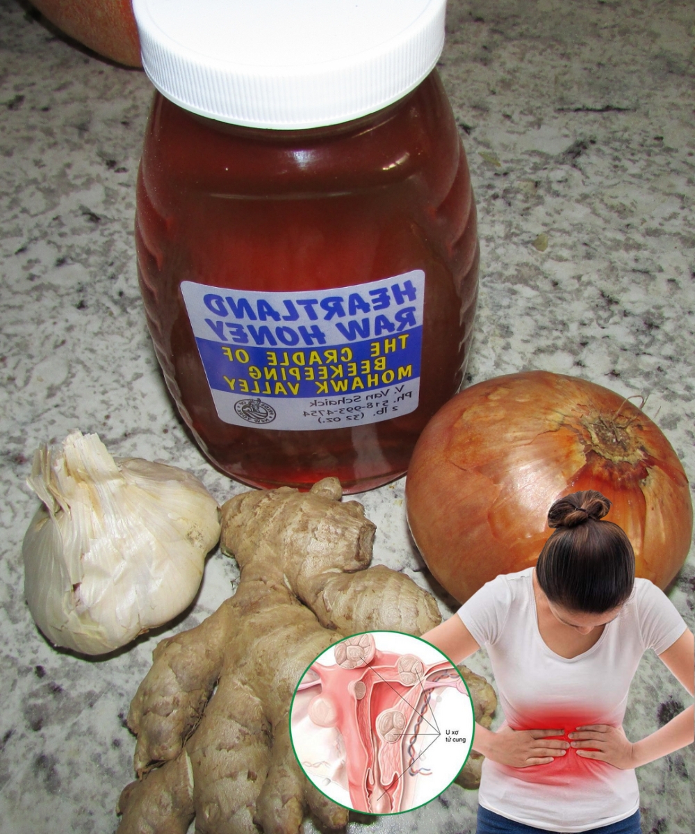 Women Should Know This! 12 Amazing Benefits of the Onion, Ginger, Garlic & Honey Mix