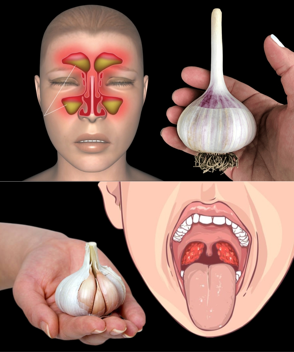 Beat Urinary Infections Naturally with Garlic – Here’s How!