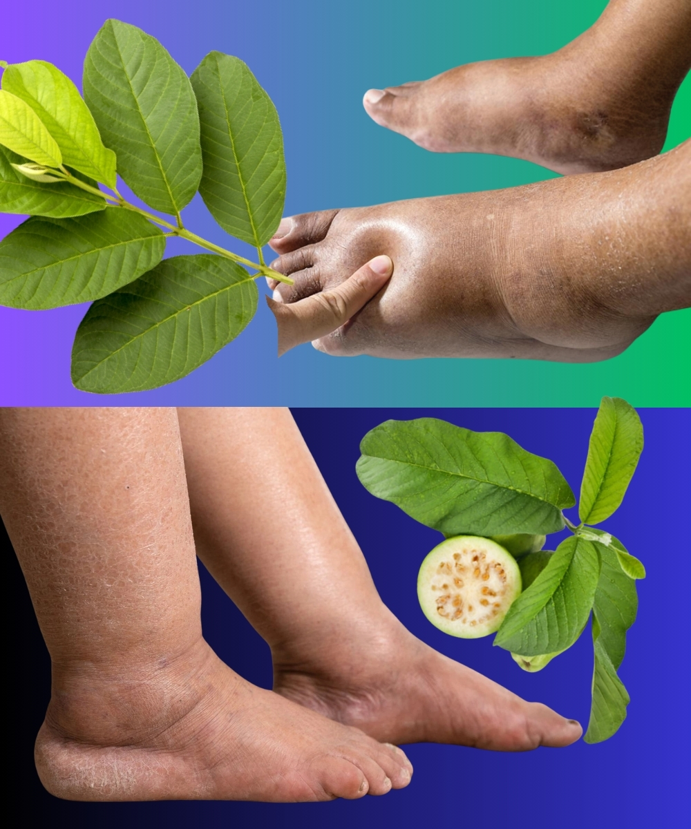 Beat Water Retention Naturally with This Simple Guava Leaf Remedy!