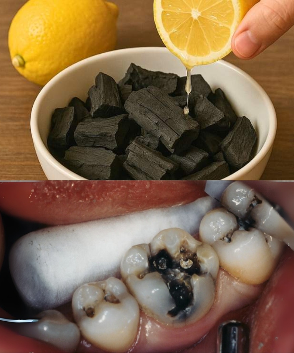 Protect and Repair Your Teeth Naturally – Simple Remedies That Really Work!