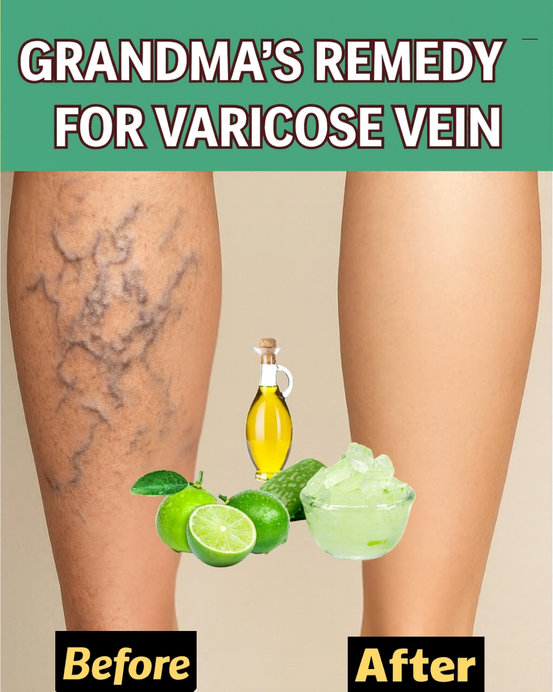 Natural Varicose Vein Relief: The Aloe, Vinegar & Lemon Remedy Grandma Swore By