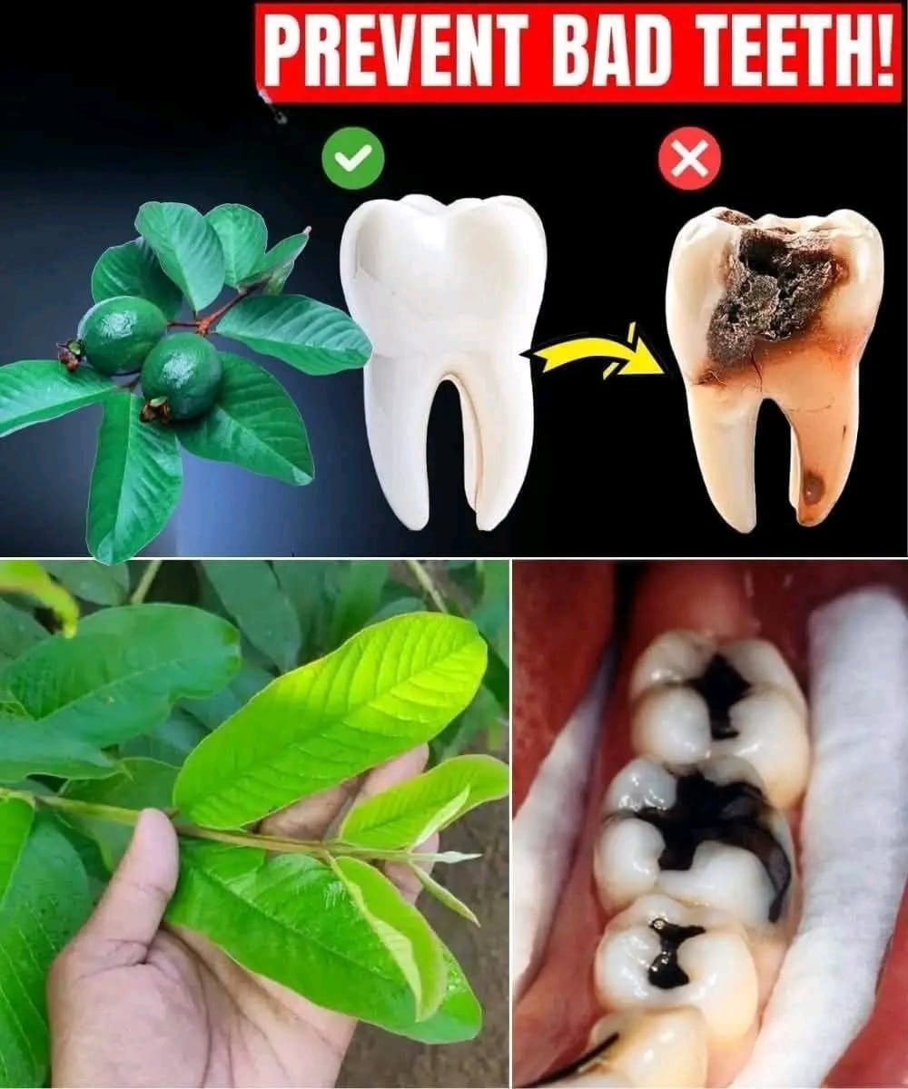 3 Simple & Cost-Effective Ways to Treat Tooth Decay Using Guava Leaves
