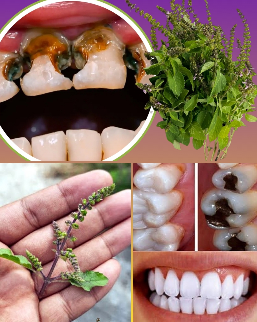 Stronger Teeth, Healthier Gums: Why Tulsi Is the Ultimate Oral Care Herb