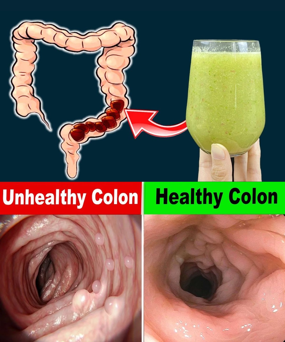 🌿 17 Easy Natural Habits to Keep Your Colon Healthy