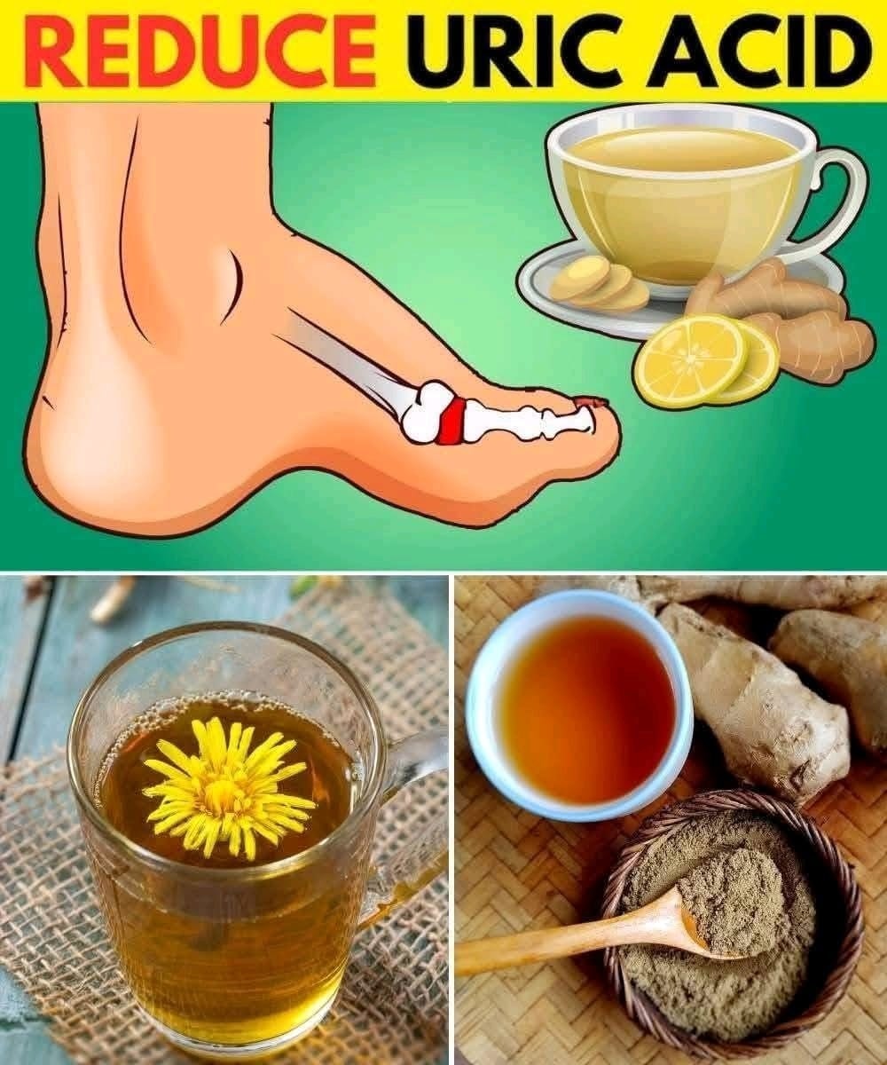 12 Herbal Teas to Naturally Lower Uric Acid and Soothe Gout Pain