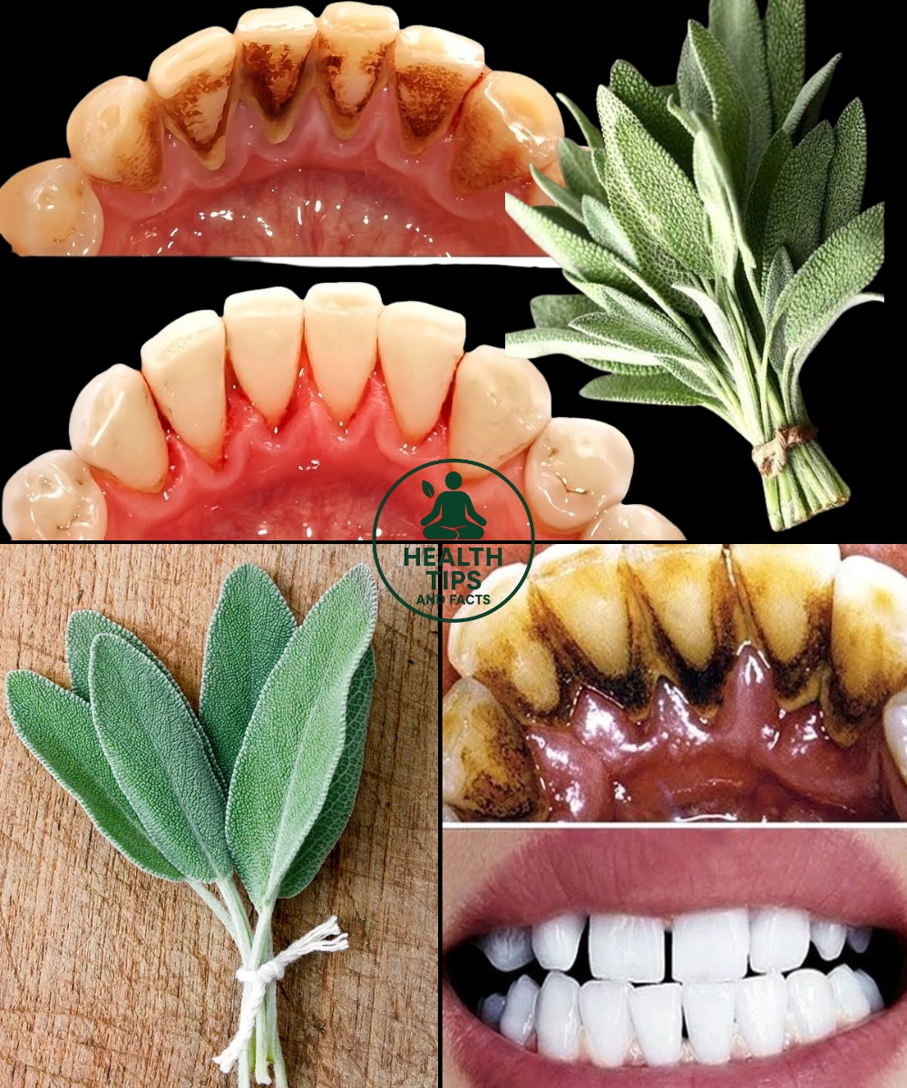 Whiten Your Teeth and Remove Tartar Naturally with This Simple Sage Leaf Trick!