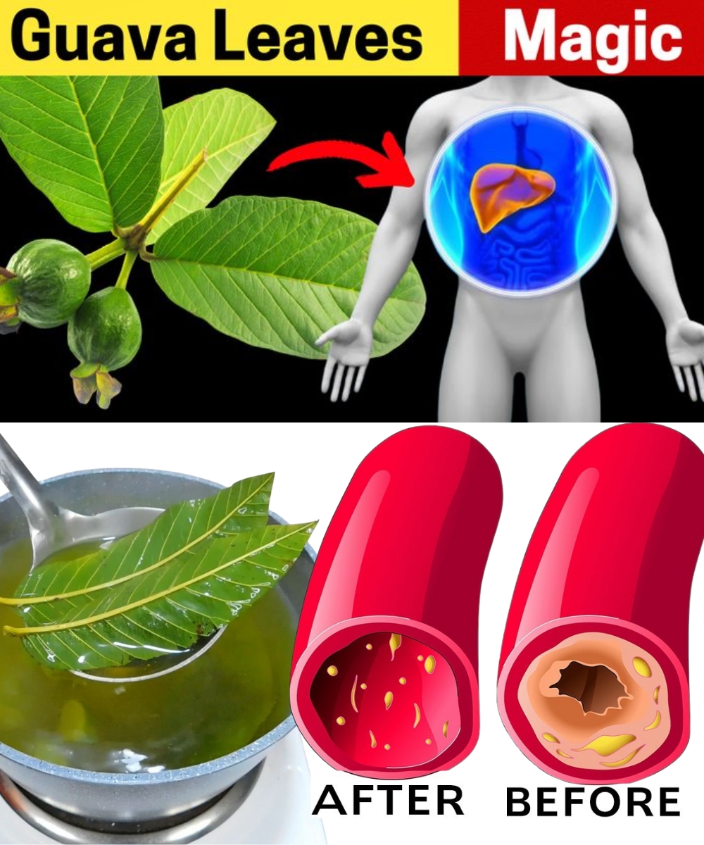 17 Surprising Guava Leaf Benefits You Never Knew Existed!