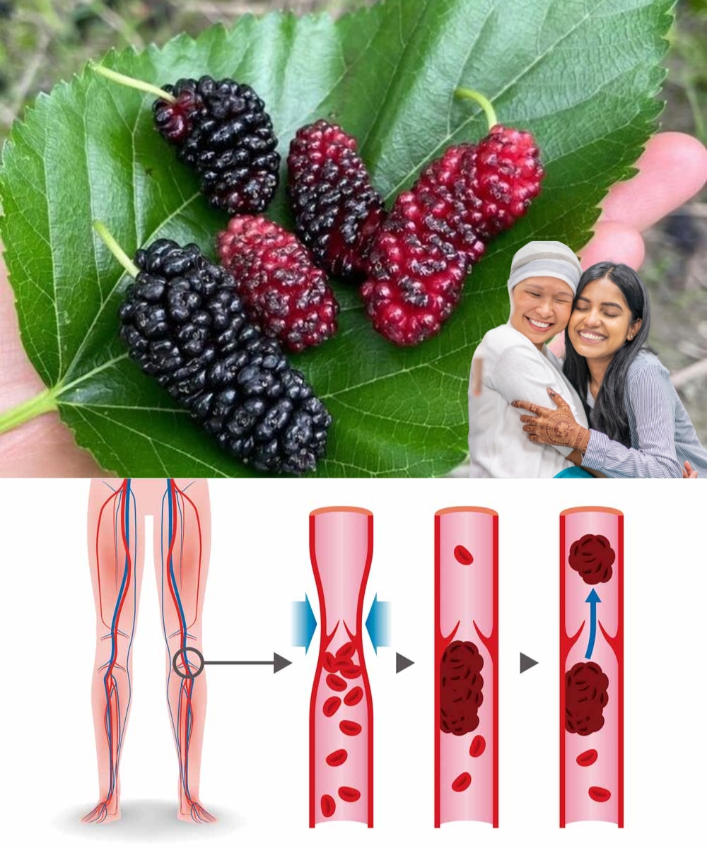 This One Powerful Leaf Can Help With Diabetes, High Blood Pressure, Body Pain, Cholesterol & Circulation — You Won’t Believe Its Benefits!